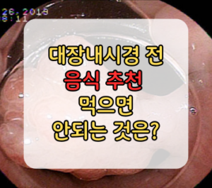 대장내시경 전 음식 추천 섭취하면 안되는 것은? 대장내시경 전 음식 추천 섭취하면 안되는 것은?
