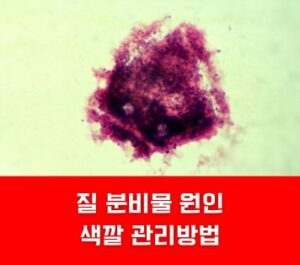 질 분비물 원인 색깔 관리방법 질 분비물 원인 색깔 관리방법