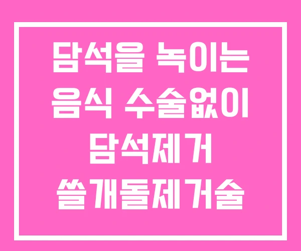 담석을 녹이는 음식 수술없이 담석제거 쓸개돌제거술 담석을 녹이는 음식 수술없이 담석제거 쓸개돌제거술