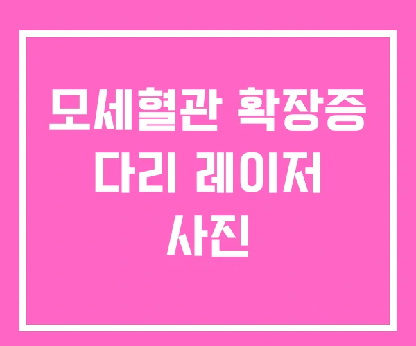 모세혈관 확장증 다리 레이저 사진