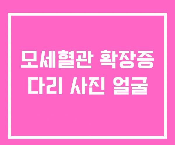 모세혈관 확장증 다리 사진 얼굴