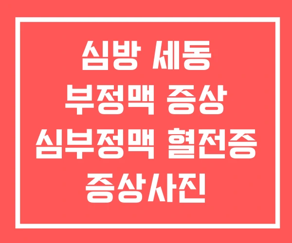 심방 세동 부정맥 증상 심부정맥 혈전증 증상사진 심방 세동 부정맥 증상 심부정맥 혈전증 증상사진